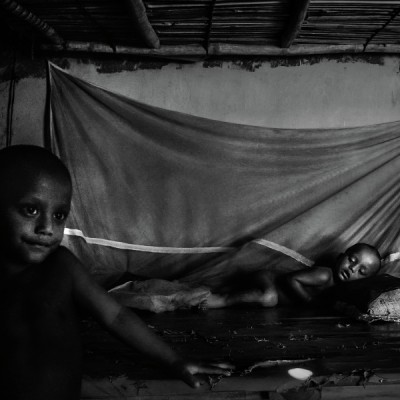 Curious touch on open eyes, lips n dreams in sleep